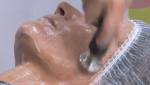 Radiofrecuencia Indiba facial